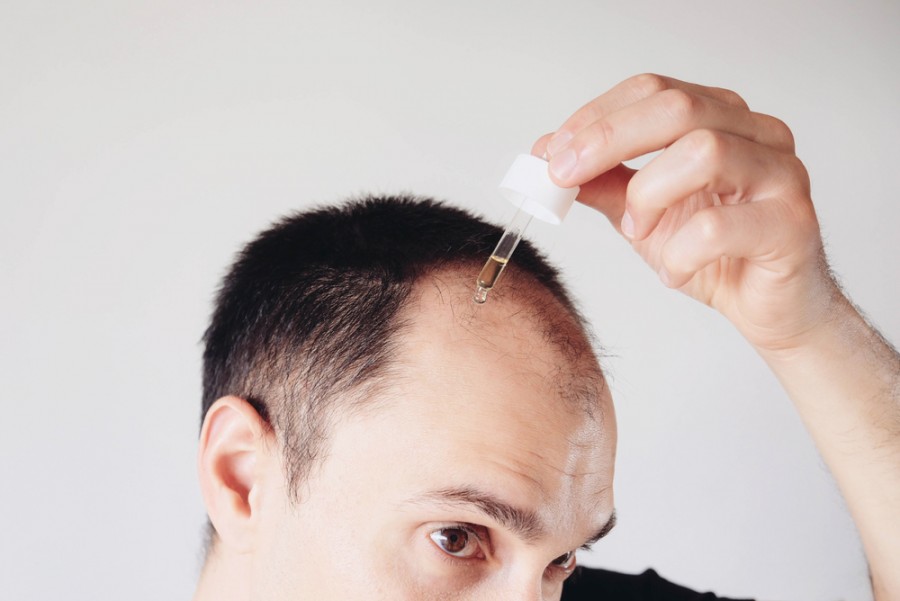 Quel est le meilleur remède pour la repousse des cheveux ?